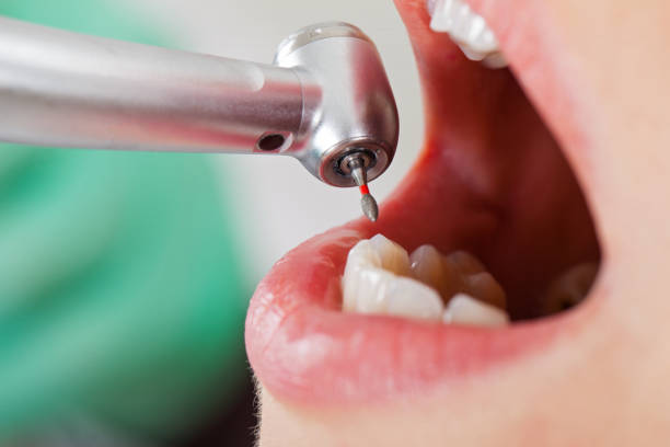 Best Emergency Tooth Extraction  in Seyur, MO